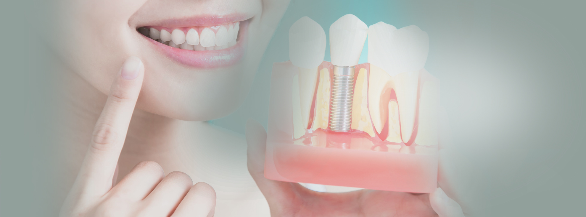Dentalara